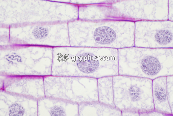 Mitose dans une racine de Blé (interphases) x200  - gryphea.com